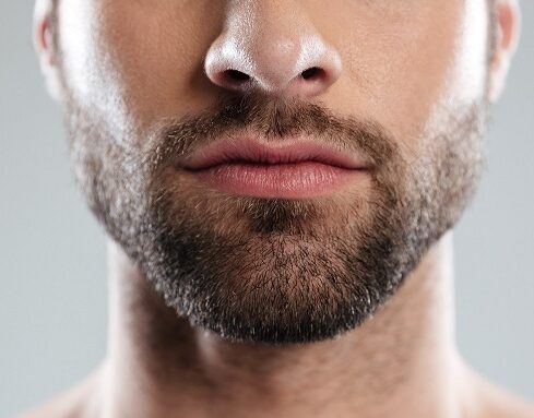 Beard Transplant