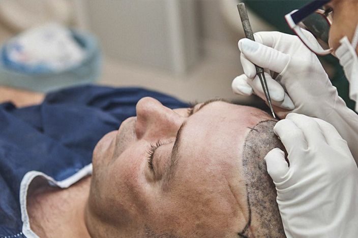 hair transplant surgery turkey