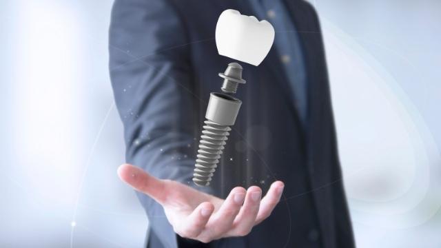 Dental Implants Surgery Dental Implant Structure