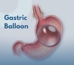 Weight Loss Procedures