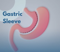 Weight Loss Procedures
