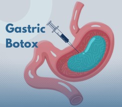Weight Loss Procedures
