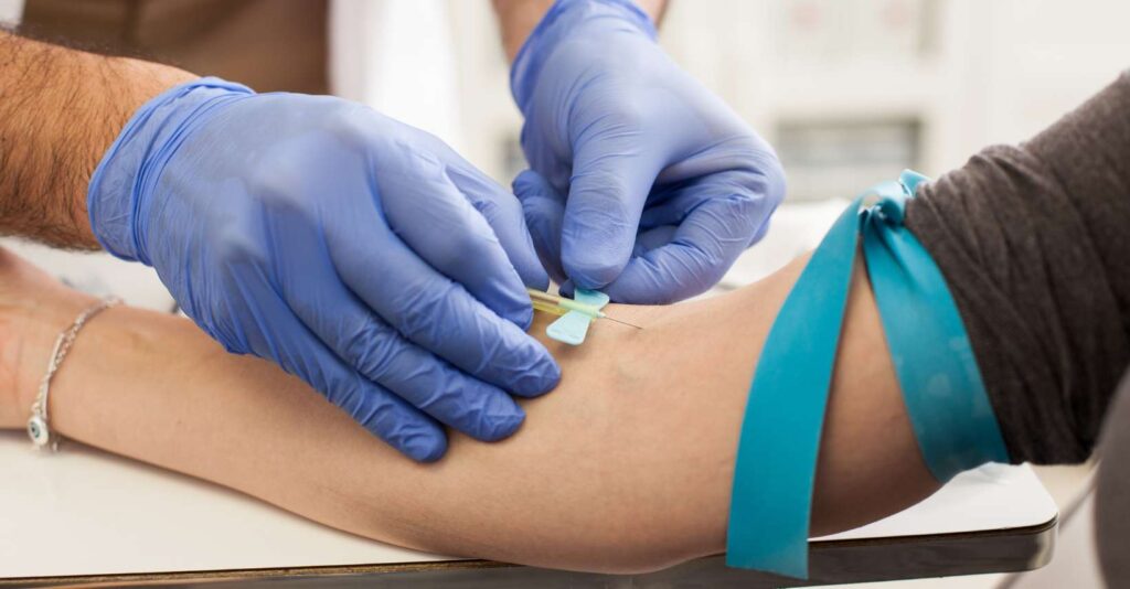 Platelet-Rich Plasma (PRP)