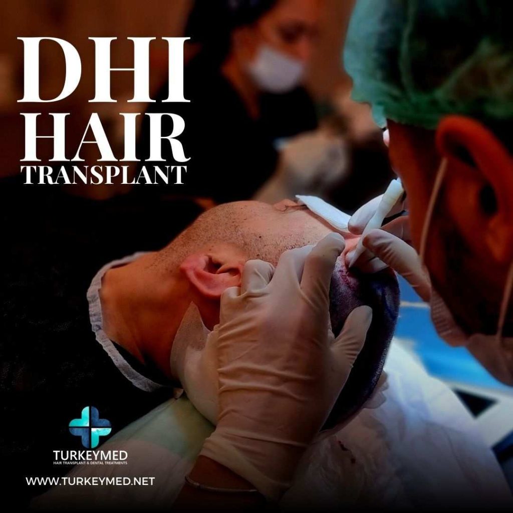 hair surgery turkey