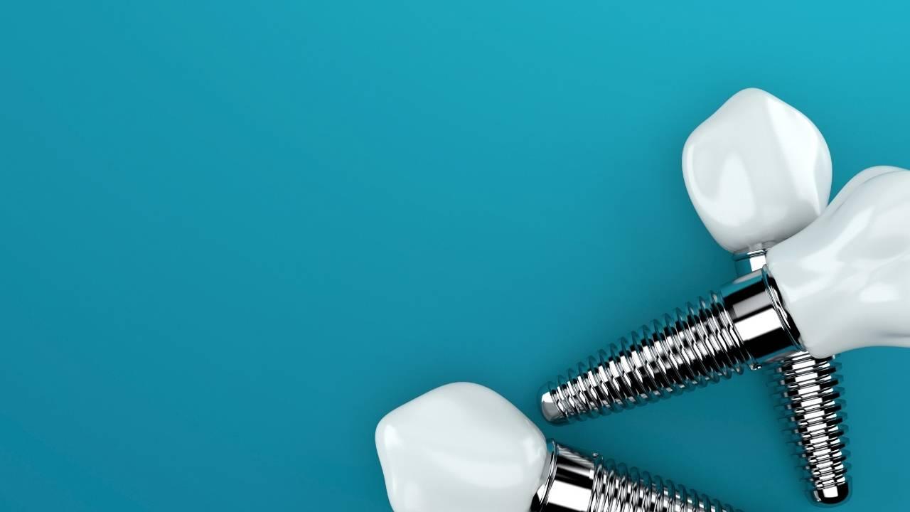 Dental Implants Surgery