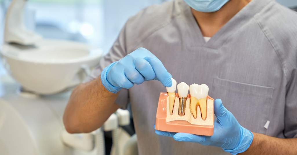 Implante dental en Turquía
