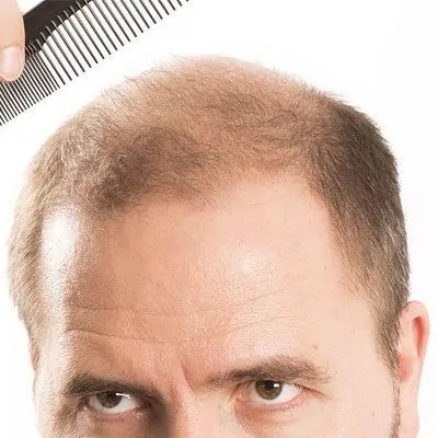 Hair transparent