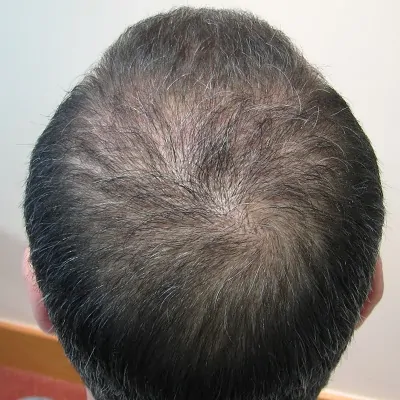 Hair transparent